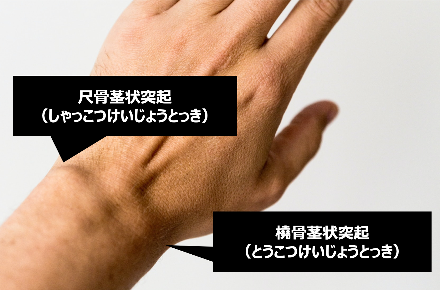 指の関節の解剖学